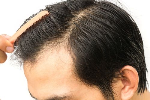 مميزات وعيوب زراعة الشعر الصناعي في دبي