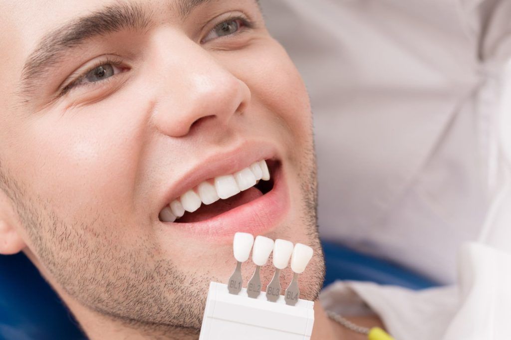 تجارب فينير الأسنان في تركيا