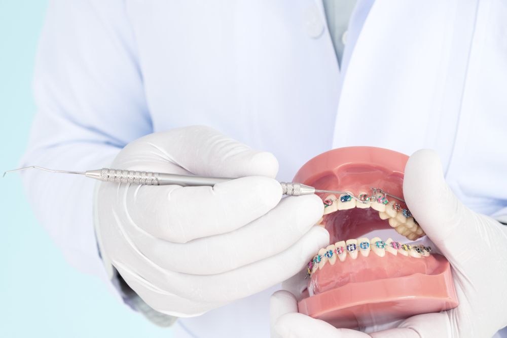 العوامل التي تؤثر على تكلفة تقويم الأسنان في جدة