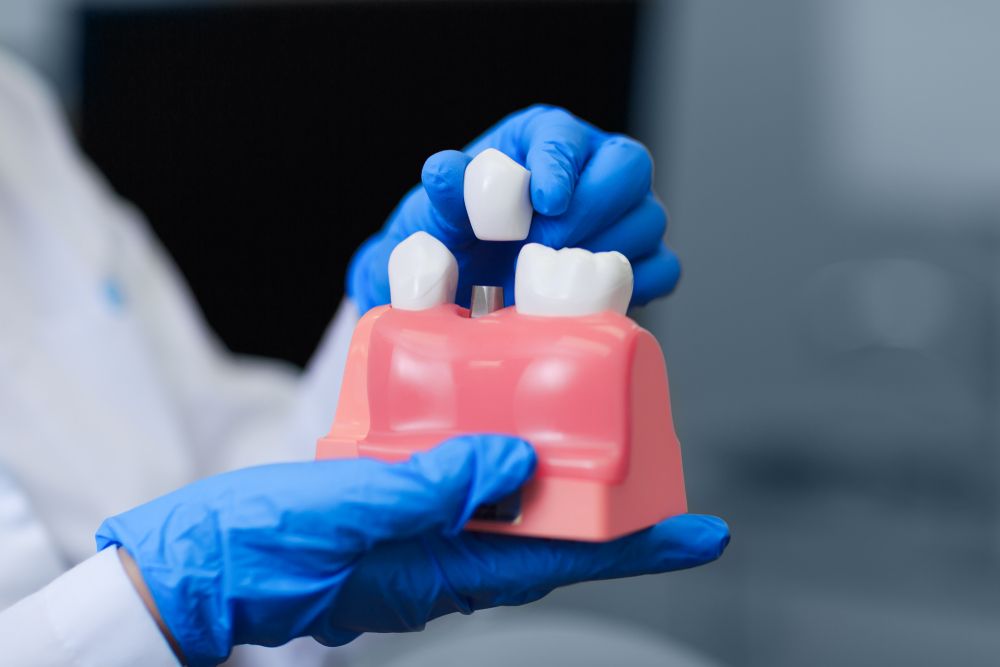 زراعة الأسنان باستخدام الخلايا الجذعية