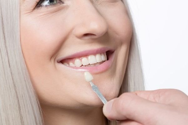 مميزات تعديل الاسنان بدون تقويم 