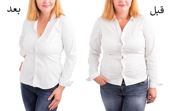 ما هي مميزات وعيوب عملية شفط الدهون بالخبر؟