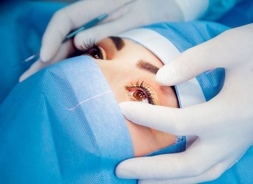 علاج الانتفاخ تحت العين بالليزر