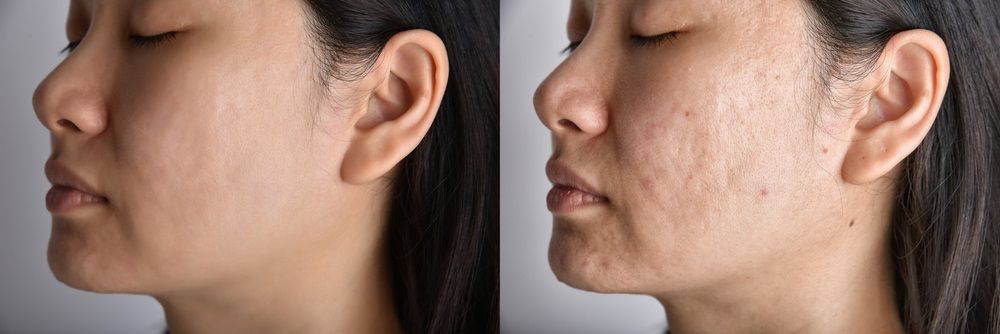 كيفية التعامل مع آثار جروح الوجه