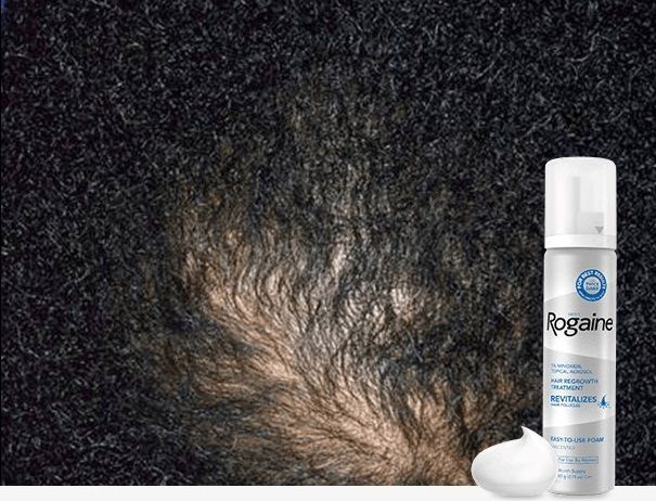كيف يعمل بخاخ روجين للشعر Rogaine Hair Spray؟