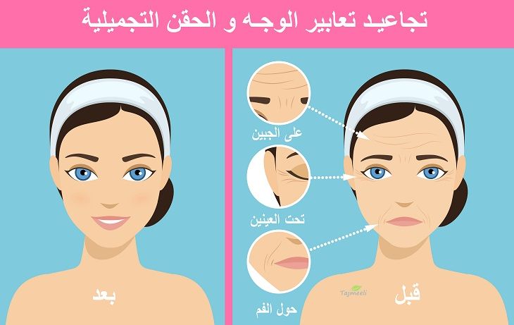 ما هي عملية شد بشرة الوجه؟