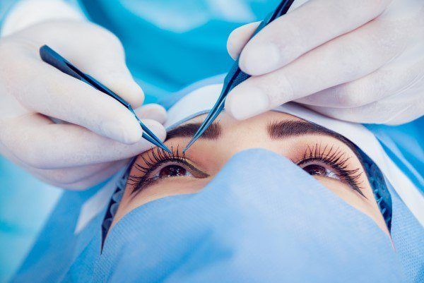 كيف تختار الطبيب المناسب لعملية توسيع العيون؟