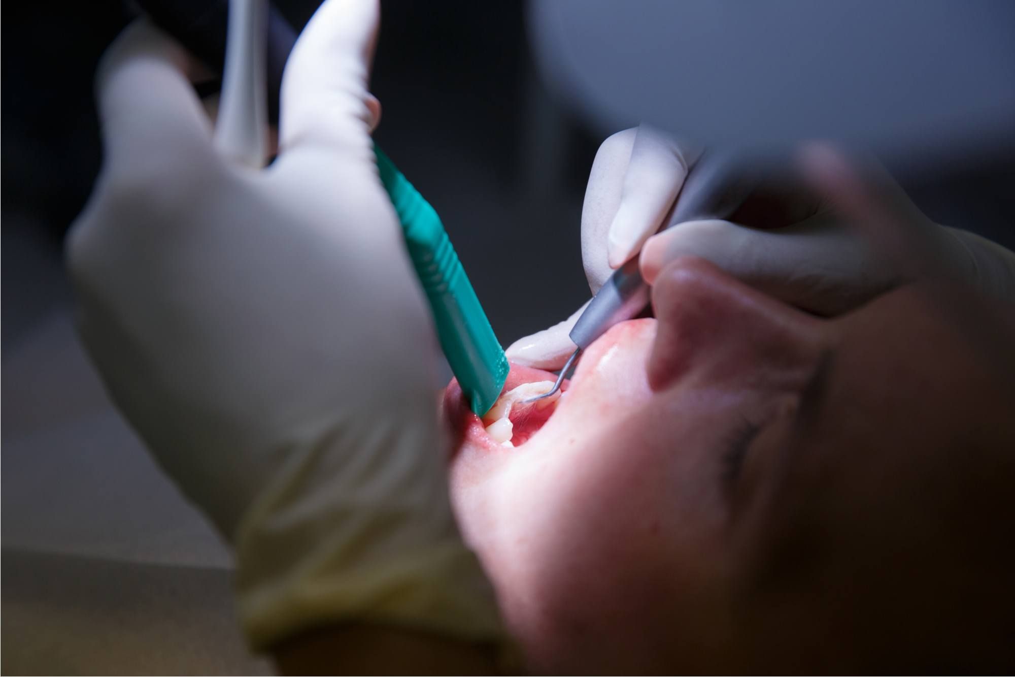 عيادات وأطباء تجميل الأسنان في الجزائر