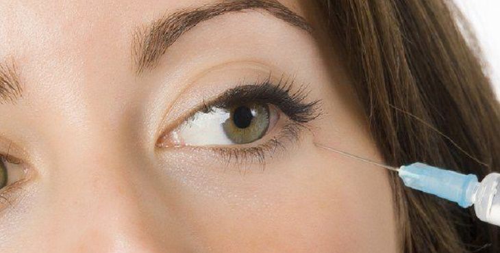 طرق غير جراحية لعلاج الانتفاخ في جفن العين