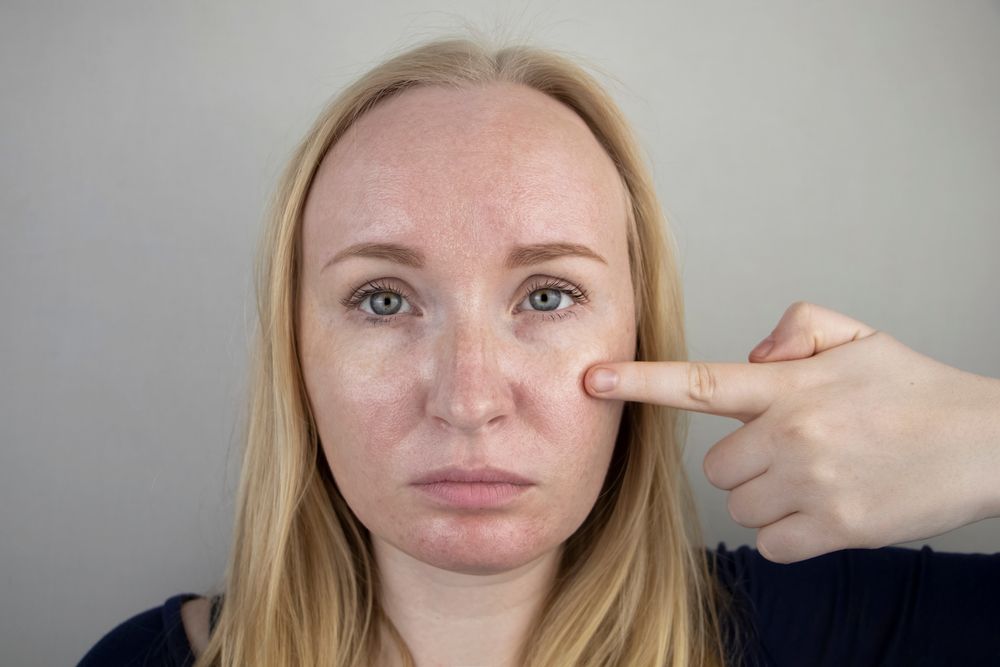 يساعد فانو كريم على علاج التهابات الوجه
