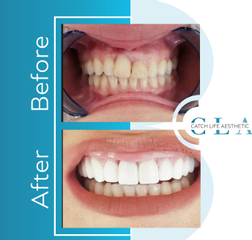 Dental-Before-After