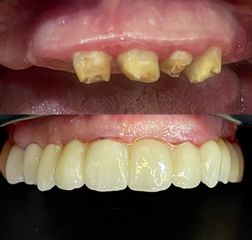 تجميل الأسنان (5)