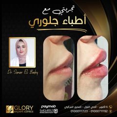 تجميل الشفايف (2)