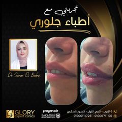 تجميل الشفايف (5)