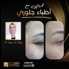 علاج-التجاعيد-4