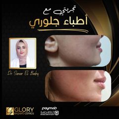 علاج-التصبغات