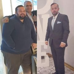 Obesity Surgery