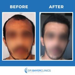 Photo from Dr. Bayer Clinics