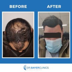 Photo from Dr. Bayer Clinics