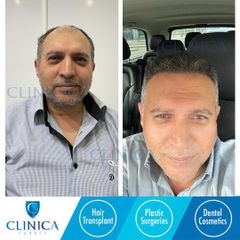 Clinica turkey