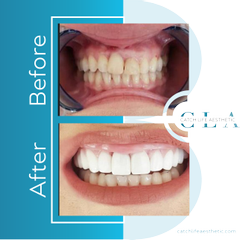 Dental Before After