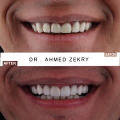 DR AHMED ZEKRY TEMPLET