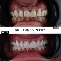 DR AHMED ZEKRY TEMPLET2