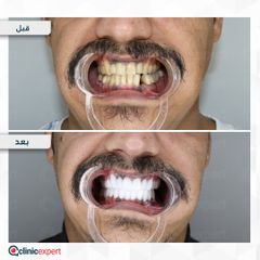 Tajmeeli-Dental-6