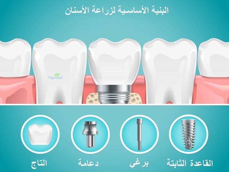 ماذا يجب أن تعرف عن عمليات الأسنان في الإمارات