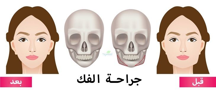 نبذة عن جراحة الوجه والفكين في دولة المغرب