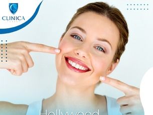 زراعة الأسنان وإبتسامة هوليوود بافضل التقنيات وضمان مدى الحياة