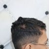 نمو الشعر في منطقة مجروحة