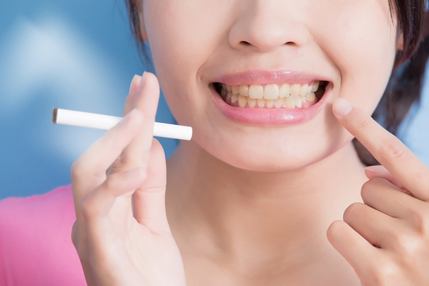 أنواع تبييض الاسنان