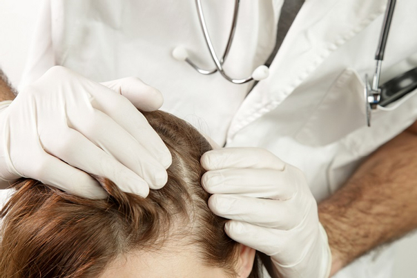 ماذا يحدث في أول زيارة لطبيب تساقط الشعر؟