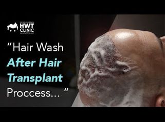 
Hair Wash After Hair Transplant Process