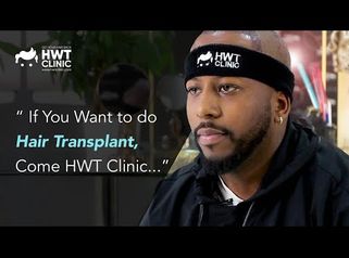 
FUE Hair Transplant Experience with HWT Clinic