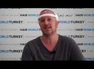 
Comments of Steven Roberts about Hair Transplant with HWT Clinic