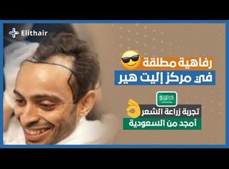 
زراعة الشعر في تركيا | تجربة السيد أمجد من المملكة العربية السعودية | إليت هير